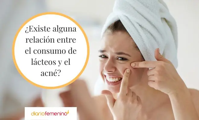 los quesos producen acne - Qué queso puedo comer si tengo acné